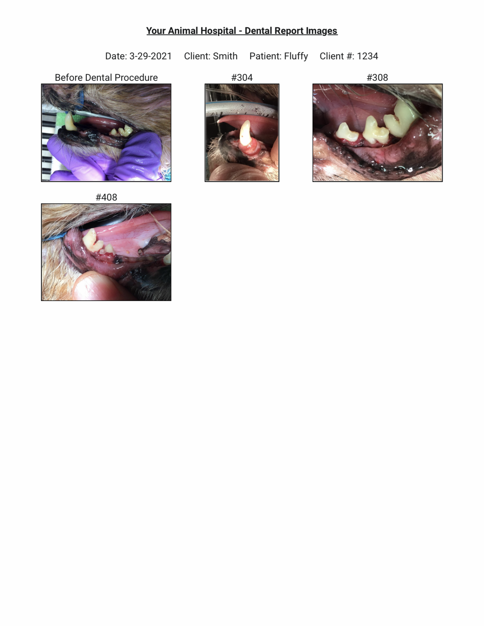 Example Patient Go Home Chart